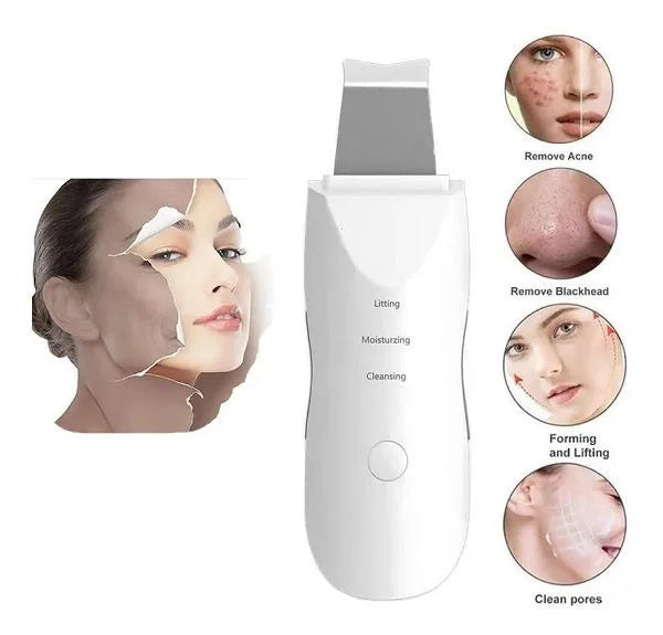 Portable Ultrasonic Peeling Skin Cleansing Removes Cloves