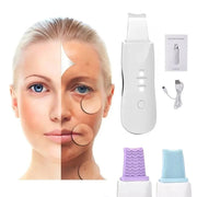 Portable Ultrasonic Peeling Skin Cleansing Removes Cloves