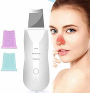 Portable Ultrasonic Peeling Skin Cleansing Removes Cloves